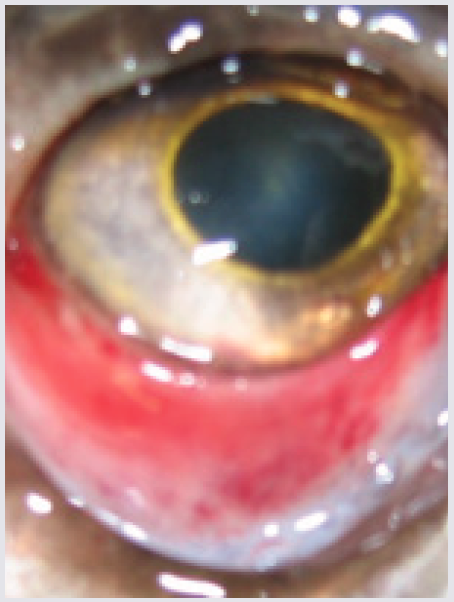 Hemorrhagic Areas Near Eye